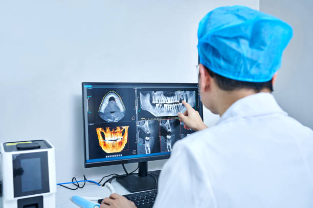 Best Emergency Wisdom Teeth Removal in Munhall, PA